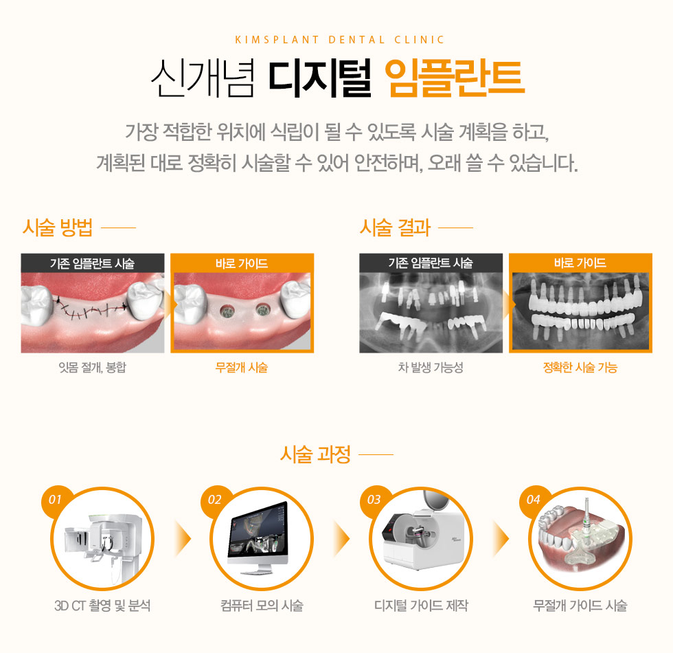 신개념 디지털 임플란트 가장 적합한 위치에 식립이 될 수 있도록 시술 계획을 하고, 계획된 대로 정확히 시술할 수 있어 안전하며, 오래 쓸 수 있습니다.